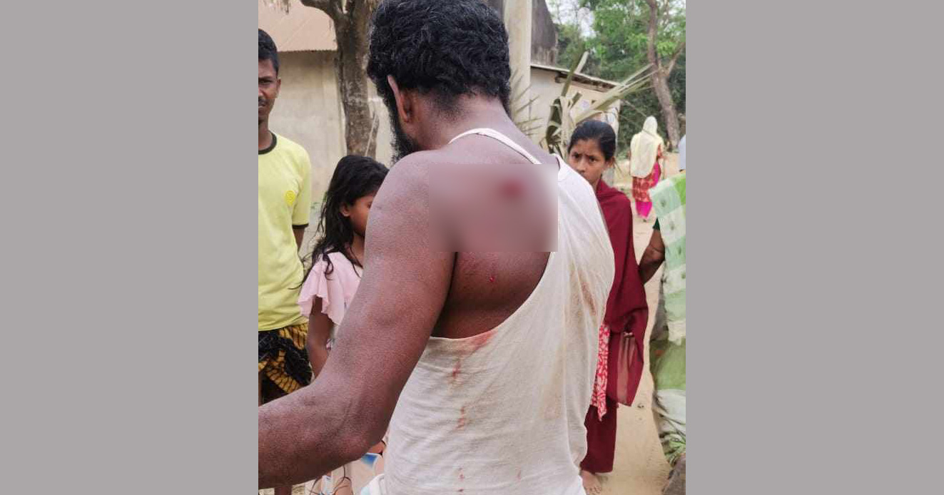 হামলায় আহত ব্যক্তি
