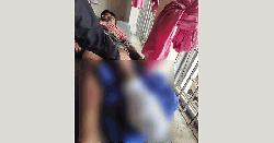 নাইক্ষ্যংছড়ি সীমান্তে ফের মাইন বিস্ফোরণ, বিএনপি নেতার পা বিচ্ছিন্ন 