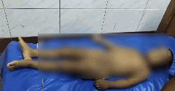 গলায় লিচুর বিচি আটকে শিশুর মৃত্যু