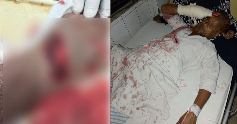 কোরবানির পশু বিক্রিতে চাঁদা না পেয়ে বৃদ্ধকে কুপিয়ে জখমের অভিযোগ