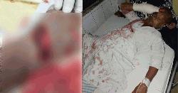 কোরবানির পশু বিক্রিতে চাঁদা না পেয়ে বৃদ্ধকে কুপিয়ে জখম