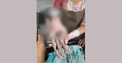 নাটোরে জোড়া লাগানো শিশুর জন্ম, পরিবারে কান্নার রোল