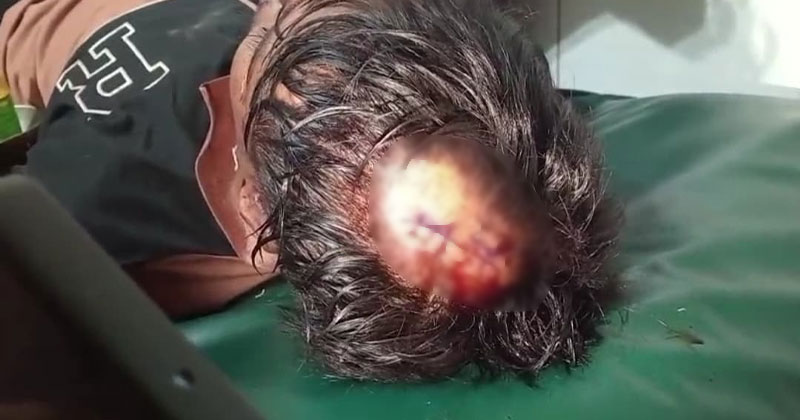শ্বশুর বাড়িতে বেড়াতে এসে শ্যালকের কোপের শিকার হয়েছেন বোন জামাই।