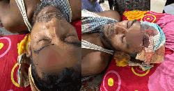 পূর্ব শত্রুতার জেরে স্বামী-স্ত্রীকে কুপিয়ে জখম