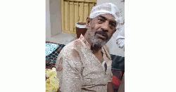 পাবনায় প্রকাশ্যে নিজ বাড়িতে প্রবীণ অধ্যাপককে কোপালো দুর্বৃত্তরা