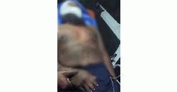 গুরুদাসপুরে জমি বিরোধে ব্যবসায়ীকে কুপিয়ে জখম