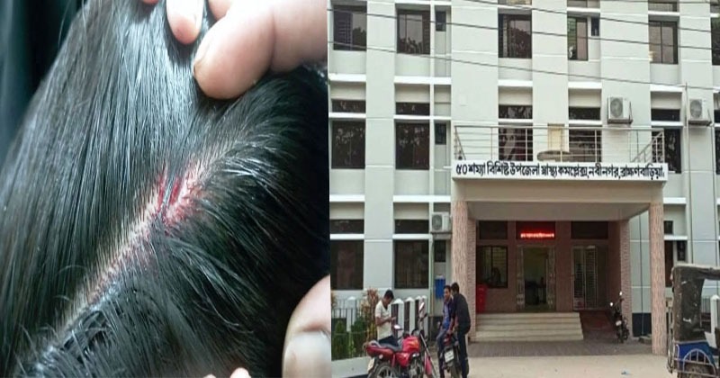 ব্রাহ্মণবাড়ীয়ায় চিকিৎসা পেতে বিলম্ব হওয়ায় নার্সের মাথা ফাটালো রোগীর স্বজন