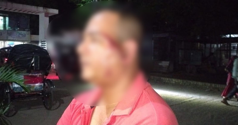 তাকে উদ্ধার করে রাজবাড়ি সদর হাসপাতালে ভর্তি করা হয়। এবং পরে উন্নত চিকিৎসার জন্য ফরিদপুর মেডিকেল কলেজ হাসপাতালে পাঠানো হয়েছে।