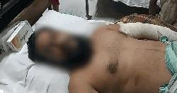 মাদারীপুরে তাঁতী দলের সাধারণ সম্পাদককে কুপিয়ে জখম