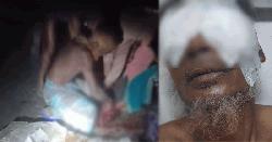 ভাইয়ের চোখ তুলে নেওয়ার ভিডিও ভাইরাল, নেপথ্যে যা জানা গেল