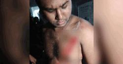 রুমমেটকে ছুরিকাঘাত, হল থেকে বহিষ্কার ডাকসুর ভিপি প্রার্থী জালাল 