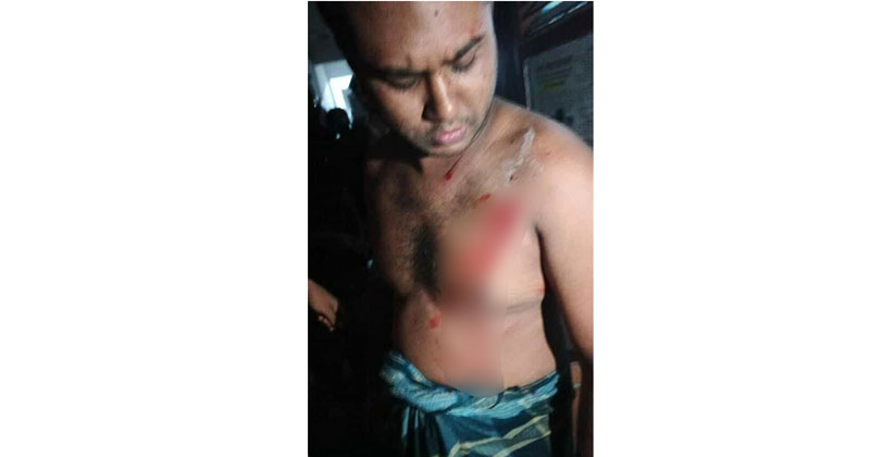 তাকে চিকিৎসার জন্য হাসপাতালে ভর্তি করা হয়েছে