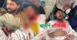 রণক্ষেত্র বিজয়নগর, জাপা-গণঅধিকার পরিষদের সংঘর্ষে রক্তাক্ত নূর