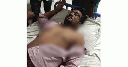 নুরের উপর হামলার প্রতিবাদে বিক্ষোভ মিছিলে ছাত্রদলের হামলা, আহত ৫