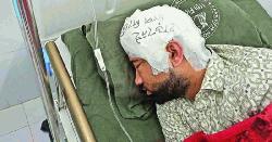 মাথায় লেখা ‘হাড় নেই, চাপ দিবেন না’