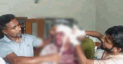 জুয়েলারী ব্যবসায়ীকে কুপিয়ে স্বর্ণ লুটের চেষ্টা