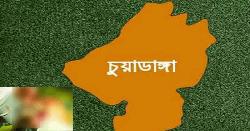 অপারেশনের তিন মাস পর রোগীর পেট থেকে বের হলো গজ কাপড়