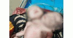 নেছারাবাদে দুই মাথা বিশিষ্ট বিরল শিশুর জন্ম