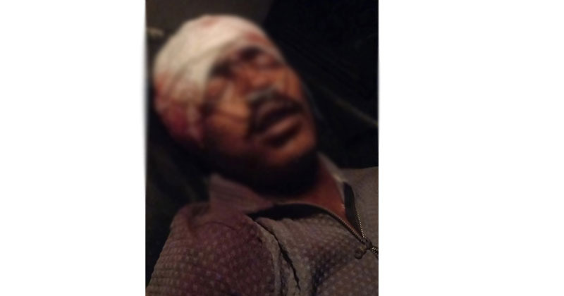 নবীনগরে হোটেলে ঢুকে গুলিবর্ষণে আরেক জনের মৃত্যু, নিহত বেড়ে ২