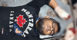 শার্শায় বোমা বিস্ফোরণে তরুণ গুরুতর আহত
